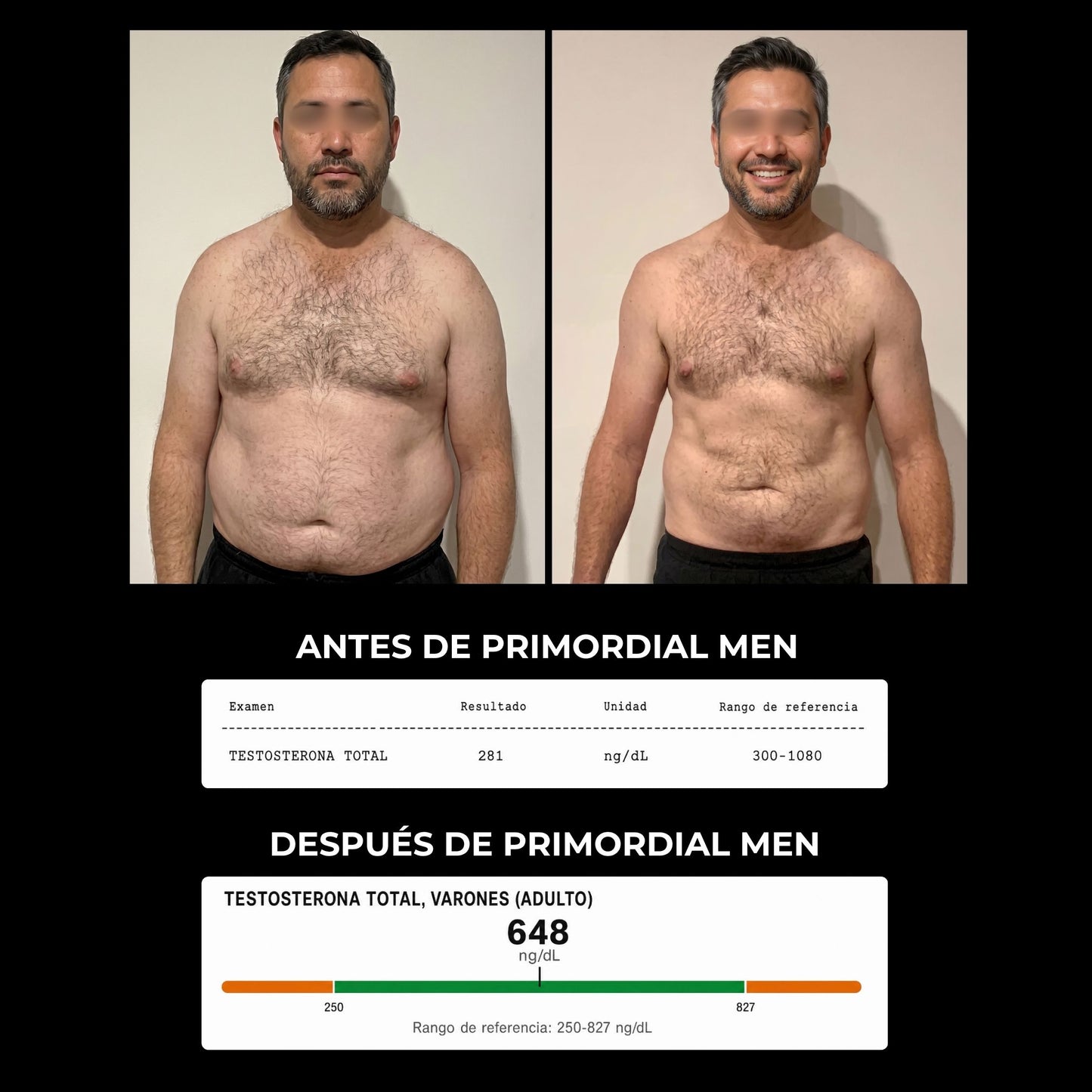 Soporte Natural de Testosterona